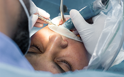 Cirurgia Oral com anestesia geral